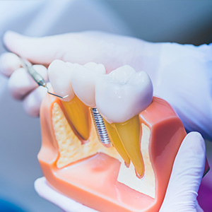 Dental Illuminations | Periodontal Treatment, Cosmetic Dentistry and CEREC reg